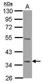 Anti-Decorin antibody used in Western Blot (WB). GTX101247