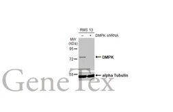 Anti-DMPK antibody used in Western Blot (WB). GTX101248