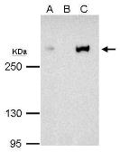 Anti-CBP antibody [C3], C-term used in Immunoprecipitation (IP). GTX101249