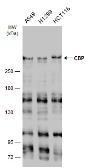 Anti-CBP antibody [C3], C-term used in Western Blot (WB). GTX101249