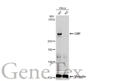 Anti-CBP antibody [C3], C-term used in Western Blot (WB). GTX101249