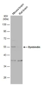 Anti-Dysbindin antibody used in Western Blot (WB). GTX101252