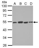Anti-Dysbindin antibody used in Western Blot (WB). GTX101252