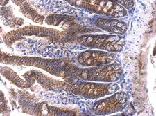 Anti-beta Catenin antibody used in IHC (Paraffin sections) (IHC-P). GTX101254