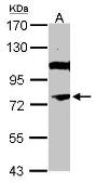 Anti-NR4A3 antibody used in Western Blot (WB). GTX101258