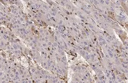 Anti-C Reactive Protein antibody [N1C3] used in IHC (Paraffin sections) (IHC-P). GTX101262
