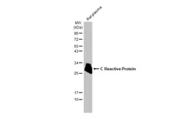 Anti-C Reactive Protein antibody [N1C3] used in Western Blot (WB). GTX101262