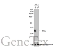 Anti-GBA antibody [C1C3] used in Western Blot (WB). GTX101267