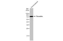 Anti-Thrombin antibody used in Western Blot (WB). GTX101270