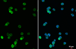 Anti-Lck antibody [C1C3] used in Immunocytochemistry/ Immunofluorescence (ICC/IF). GTX101275