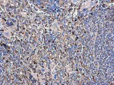 Anti-beta Tubulin antibody used in IHC (Paraffin sections) (IHC-P). GTX101279