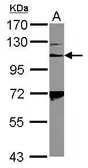 Anti-CD41 antibody [C1C3] used in Western Blot (WB). GTX101283