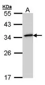 Anti-NQO1 antibody [N1C3] used in Western Blot (WB). GTX101285