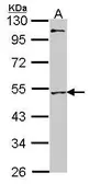 Anti-MEF2A antibody [C2C3], C-term used in Western Blot (WB). GTX101286