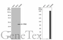 Anti-PAH antibody [N1C2] used in Western Blot (WB). GTX101290