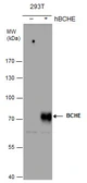 Anti-BCHE antibody [N1N3] used in Western Blot (WB). GTX101304