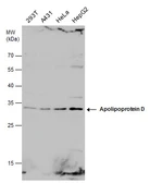 Anti-Apolipoprotein D antibody used in Western Blot (WB). GTX101306
