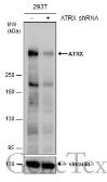 Anti-ATRX antibody [C3], C-term used in Western Blot (WB). GTX101310