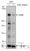 Anti-ATRX antibody [C3], C-term used in Western Blot (WB). GTX101310