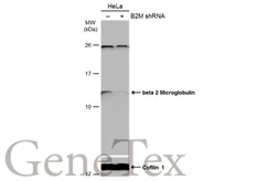 Anti-beta 2 Microglobulin antibody [N1C3] used in Western Blot (WB). GTX101314