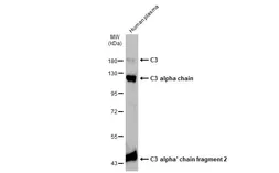 Anti-C3 / C3b antibody [C3], C-term used in Western Blot (WB). GTX101316