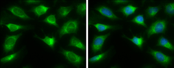 Anti-ASS1 antibody used in Immunocytochemistry/ Immunofluorescence (ICC/IF). GTX101325