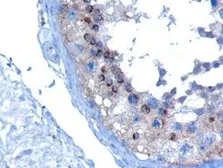 Anti-VPS28 antibody, C-term used in IHC (Paraffin sections) (IHC-P). GTX10133