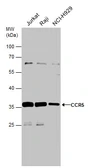 Anti-CCR5 antibody used in Western Blot (WB). GTX101330