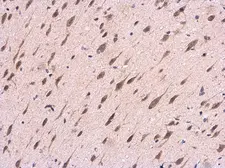 Anti-APP antibody [C2C3], C-term used in IHC (Paraffin sections) (IHC-P). GTX101336