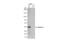 Anti-Ataxin 3 antibody used in Western Blot (WB). GTX101343