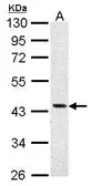 Anti-ASS1 antibody used in Western Blot (WB). GTX101344