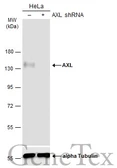 Anti-AXL antibody [C2C3], C-term used in Western Blot (WB). GTX101345