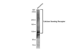 Anti-Calcium Sensing Receptor antibody used in Western Blot (WB). GTX101348
