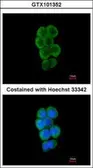 Anti-CBL antibody [C2C3], C-term used in Immunocytochemistry/ Immunofluorescence (ICC/IF). GTX101352