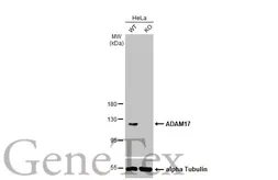 Anti-ADAM17 antibody [C2C3], C-term used in Western Blot (WB). GTX101358