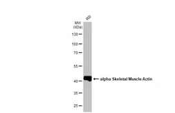 Anti-alpha Skeletal Muscle Actin antibody used in Western Blot (WB). GTX101362