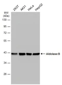 Anti-Aldolase B antibody used in Western Blot (WB). GTX101363