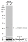 Anti-Adenosine kinase antibody [N1C1] used in Western Blot (WB). GTX101372