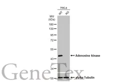 Anti-Adenosine kinase antibody used in Western Blot (WB). GTX101385