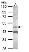 Anti-AHCY antibody [N3C3] used in Western Blot (WB). GTX101387