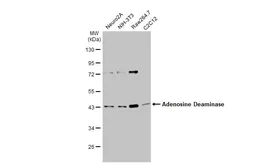 Anti-Adenosine Deaminase antibody used in Western Blot (WB). GTX101390