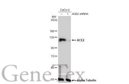 Anti-ACE2 antibody [N1N2], N-term used in Western Blot (WB). GTX101395