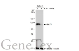 Anti-ACE2 antibody [N1N2], N-term (GTX101395) | GeneTex
