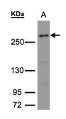 Anti-CAD antibody [C2C3], C-term used in Western Blot (WB). GTX101401