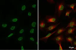 Anti-BLM antibody [N1N2], N-term used in Immunocytochemistry/ Immunofluorescence (ICC/IF). GTX101403