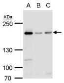 Anti-BLM antibody [N1N2], N-term used in Western Blot (WB). GTX101403