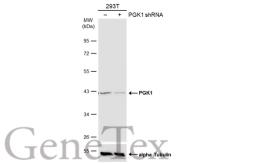 Anti-PGK1 antibody [N1C1] used in Western Blot (WB). GTX101405