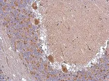 Anti-ABAT antibody used in IHC (Paraffin sections) (IHC-P). GTX101413