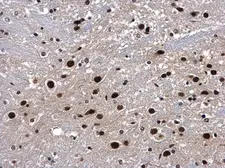 Anti-p54nrb antibody used in IHC (Paraffin sections) (IHC-P). GTX101419