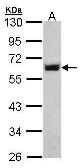 Anti-p54nrb antibody used in Western Blot (WB). GTX101419